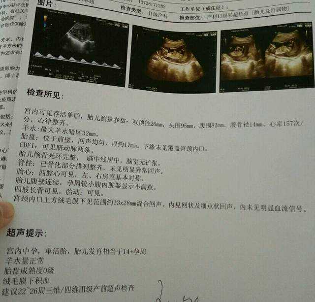 上海广州供卵助孕中心哪里好