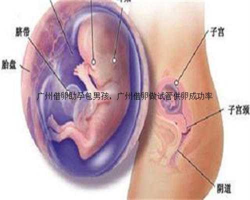 广州借卵助孕包男孩，广州借卵做试管供卵成功率