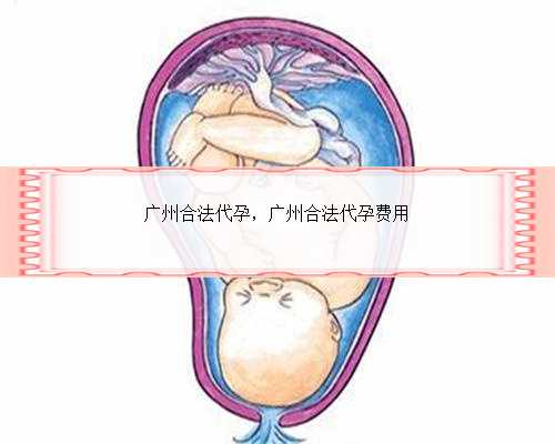 广州合法代孕，广州合法代孕费用